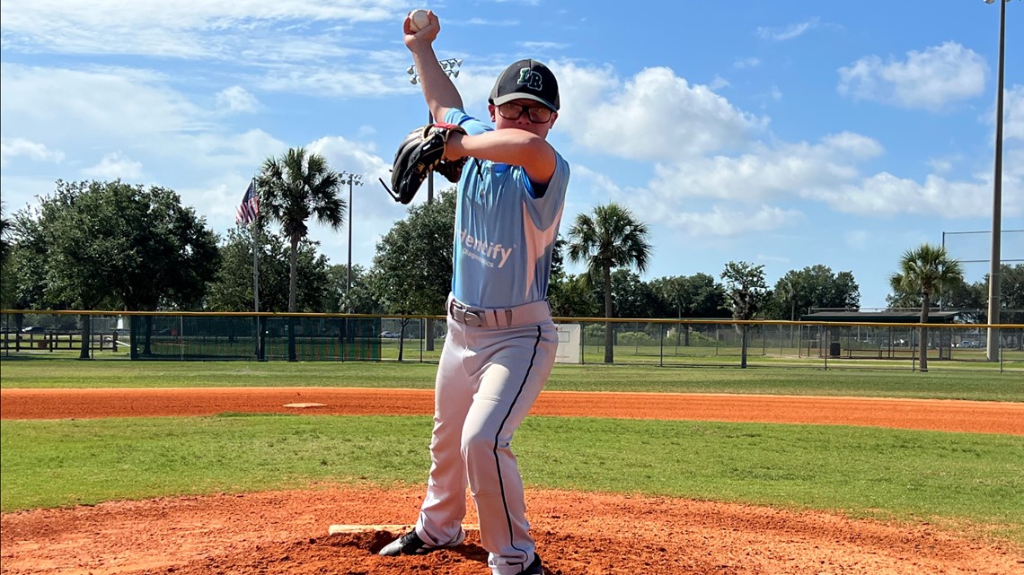 Boy with Down syndrome allowed to finish little league season - Vimarsana News