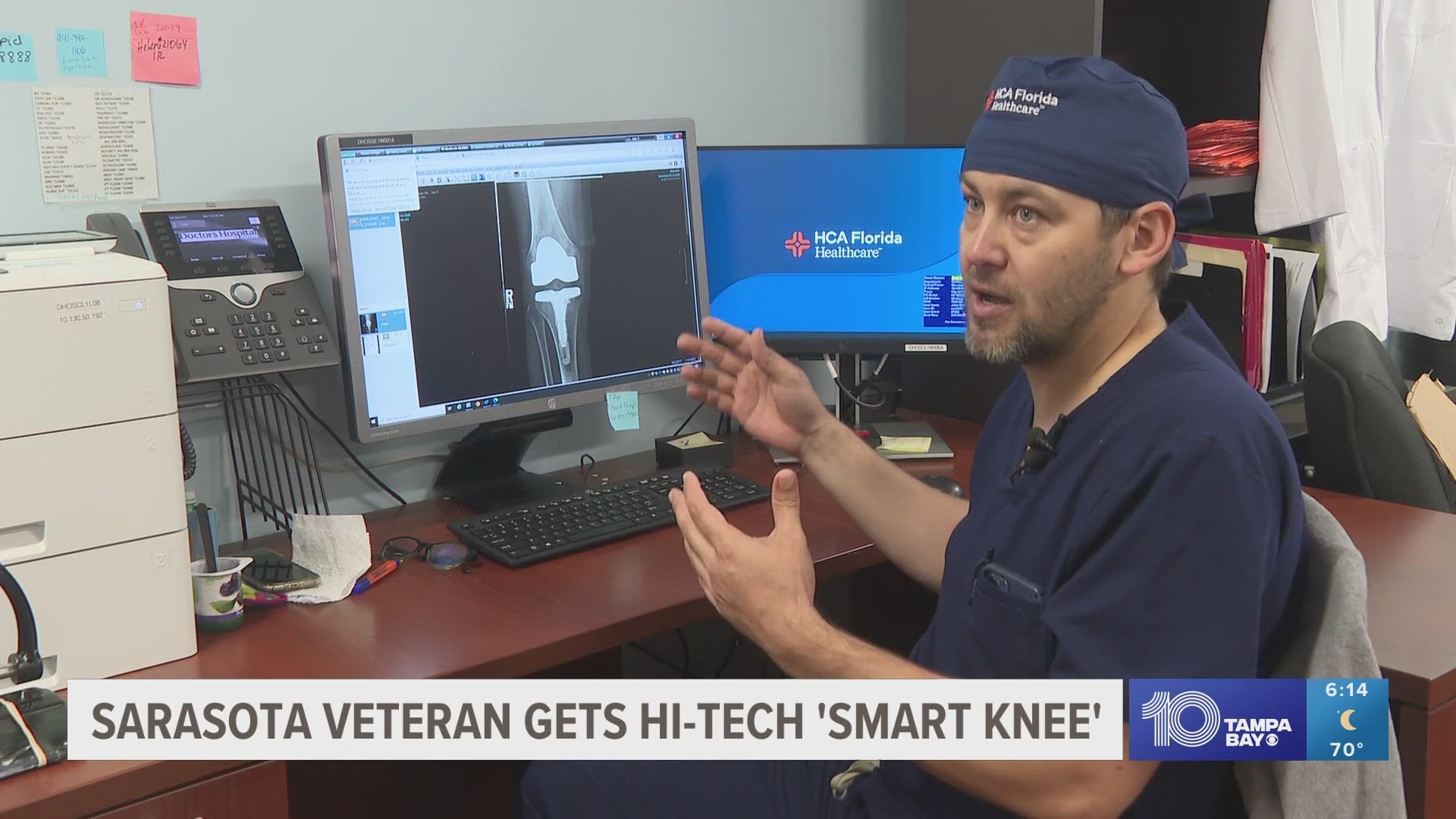 The smart knee works in tandem with a phone app that sends data based on the patient's movements.