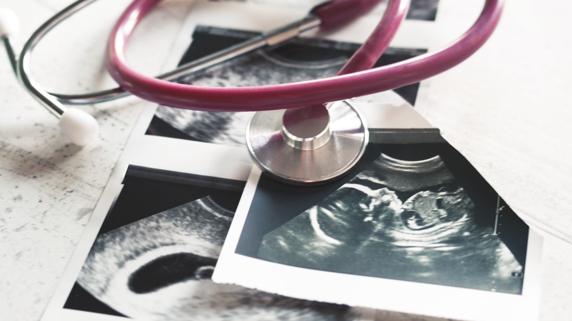 AG office: Manatee County cannot ban abortions under Florida law - Vimarsana News