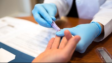 Here S Where To Get Free Hiv Testing On Thursday Wtsp Com